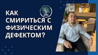 Как смирится и принять свой физический дефект на подсознательном уровне? 