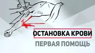 ᐈ Остановка крови – Алгоритм первой помощи при наружном кровотечении