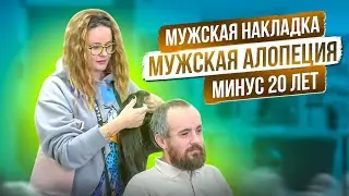 Мужская накладка. Мужская алопеция. Минус 20 лет!