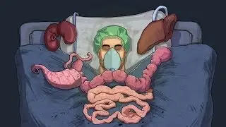 Surgeon Simulator 2013, Why Drill Why??