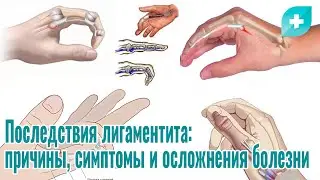 Последствия лигаментита: причины, симптомы и осложнения болезни
