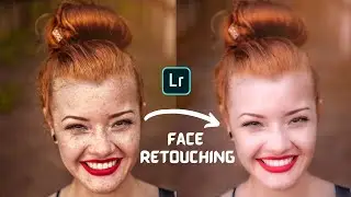 Face Retouching | Pimple Remove in lightroom mobile app in Hindi | Free lightroom presets DNG