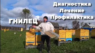 ГНИЛЕЦ Диагностика Лечение Профилактика