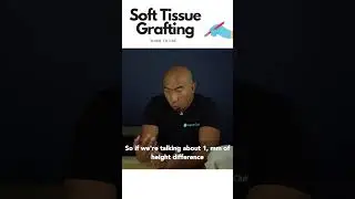 When to use soft tissue grafting around implants