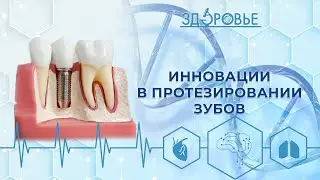 Протезирование зубов | Здоровье 06.05.2023