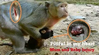 PITYFUL IN MY HEART, POOR SMALLEST MONKEY AND MUM HAVE VERY BIG INJURY, LOOK BABY VERY WEAK AND HURT