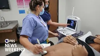 Restrictive abortion laws cause concerns about training for OB-GYN residents