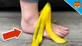 Trying The Viral Banana Peel Foot Trend💥(Shocking Results)🤯