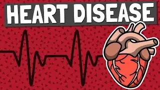 Heart Attacks and Strokes: Don't Wait Until It's Too Late