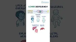LCHAD Deficiency