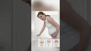 как понять что это роды. Что такое схватки. Как почувствовать схватки в родах