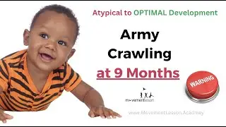 Atypical Development Baby Army Crawling at 9 Months is Not Crawling