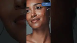 Dr. K R Sharmatha talks about the truth behind the glass skin trend | SIMS Hospital Chennai