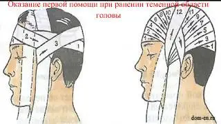 Наложение повязки 
