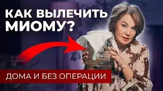 МИОМА МАТКИ | Эффективное лечение без операции