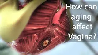 How can aging affect Vagina?