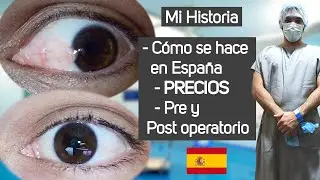 👁 CIRUGÍA DE PTERIGIÓN con Tisseel | Cómo quitar la carnosidad de los ojos 👀