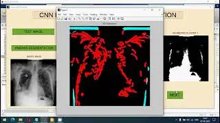 Multiple Feature Integration for Classification of Thoracic Disease in Chest Radiography | MATLAB