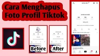 Cara Menghapus Foto Profil Tiktok | Profil Tiktok