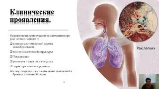 Онкология. Рак лёгкого