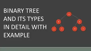 linked list representation of binary tree | array representation of binary tree | binary tree types