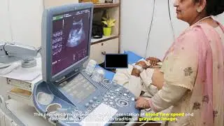 Types of Ultrasound Machine