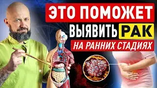 Эти симптомы ПОМОГУТ ВЫЯВИТЬ РАК на ранних стадиях || Способы диагностики онкологии