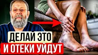 ОТЁКИ НОГ ПРОЙДУТ! Как убрать ОТЁКИ? Причины Отёков.