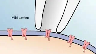 The Patch Clamp Method