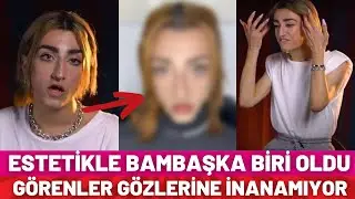 ÜNLÜ FENOMEN MİKA RAUN ESTETİKLE BAMBAŞKA BİRİ OLDU