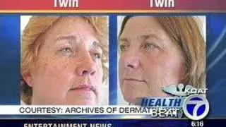 Healthbeat - Skin Damage