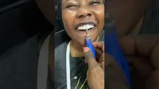 Why Would She Do This To Her Teeth?! 😳🦷