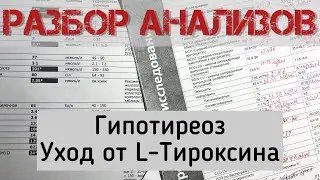 Гипотиреоз. Уход от L-Тироксина. Диетолог Ольга Владимировна Кустова