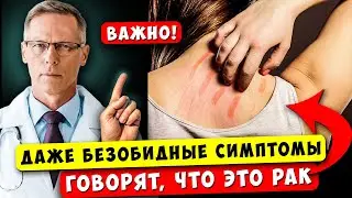 Онколог: Ранние ПРИЗНАКИ того, что РАК растет в вашем теле! 10 ПРИЗНАКОВ!