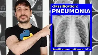 Image classification WEB APP with Python and Streamlit | Pneumonia classifier | Computer vision