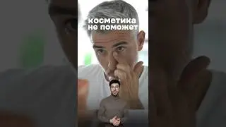 Косметика тебе не поможет!