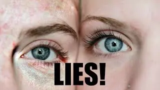 TRETINOIN  - THE GREATEST LIE EVER TOLD!