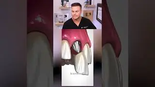 Why Your Bone DISAPPEARS If You Lose Adult Teeth! 😬🦷