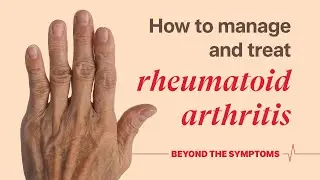 What is rheumatoid arthritis?