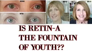 HOW I TURNED BACK THE CLOCK USING RETIN A