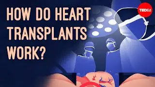 How does heart transplant surgery work? - Roni Shanoada