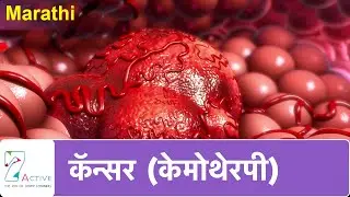 कर्करोग ( केमोथेरपी ) | Cancer (Chemotherapy) | Marathi