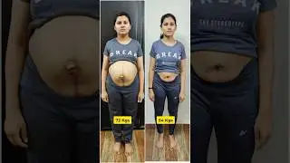 18 kgs Post Delivery Belly Fat loss at HOME (Online Plan)