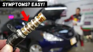 HYUNDAI SONATA SYMPTOMS OF BAD VVT SOLENOID, BAD VARIABLE TIMING SOLENOID