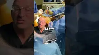 How Does a Hip Replacement Stay In Place? 🔨 Pressfit Hip Implants 