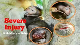 OMG PITY VERY PITY,POOR BABY BRITTANY AND HER MUM BRINN HAVE SEVERE INJURY,BABY MONKEY CRY VERY HURT