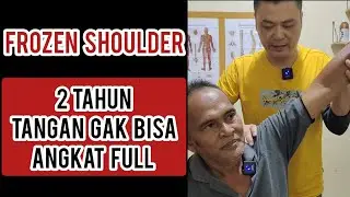 2 TAHUN TANGAN GAK BISA ANGKAT FULL 