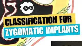 Classification for Zygomatic implants