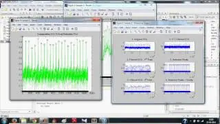 ECG Signal Processing in MATLAB - Detecting R-Peaks: Full