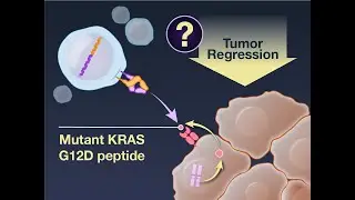 TCR Gene Therapy in Pancreatic Cancer | NEJM
